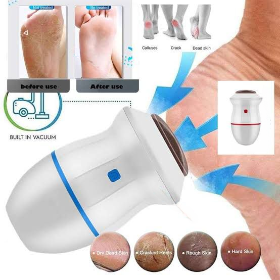 Find Back Electric Foot Vacuum Callus Remover  (Cell Operate)